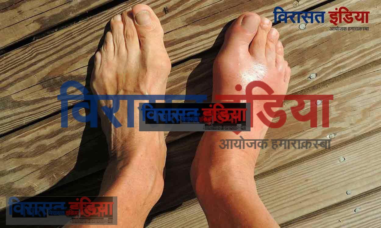 Remedies to reduce uric acid: यूरिक एसिड कम करने के घरेलू उपाय